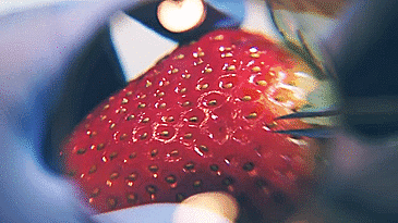 鼻子上为什么会有黑头？本文黑头图片高能警报，没做好准备勿看！