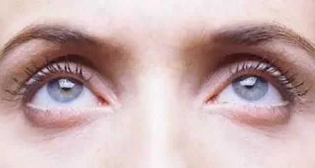  「学生妹」眼睛一单一双的学生妹，做完双眼皮竟然······