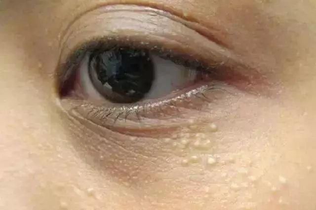 安以轩用一支“口红”同时解决了眼纹唇纹问题?