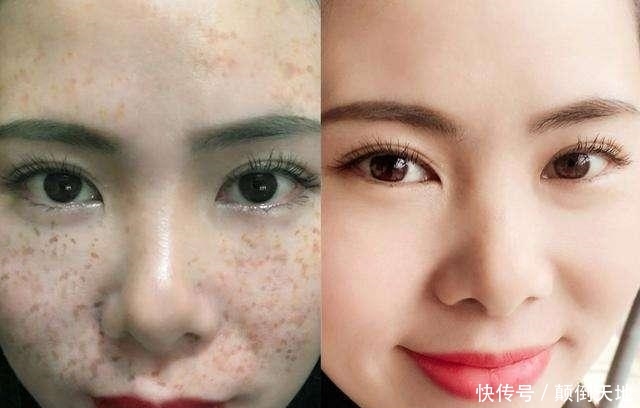  『白淡斑』蜂蜜加“它”敷脸，15天有效美白淡斑，已经强势被很多人安利了！