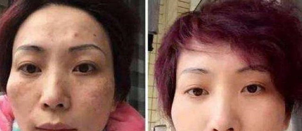 #白皙#白醋加“它”来敷脸,一周淡化色斑又美白,轻松get白皙光洁肌肤