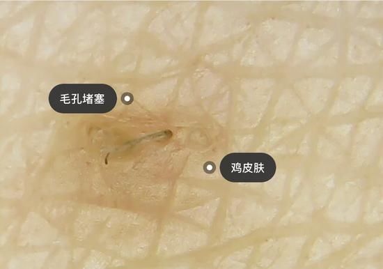 #图源小红书#身体磨皮大法 这样的肌肤谁不想摸?