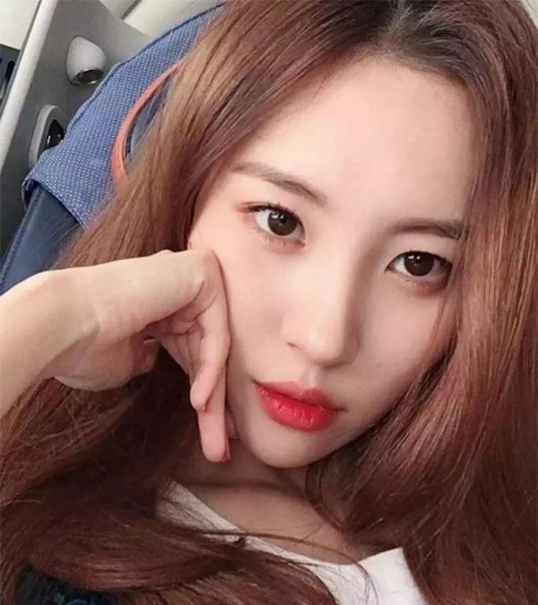  凹陷■自体脂肪填充优缺点细数，这些缺点你都知道吗，快来看看！