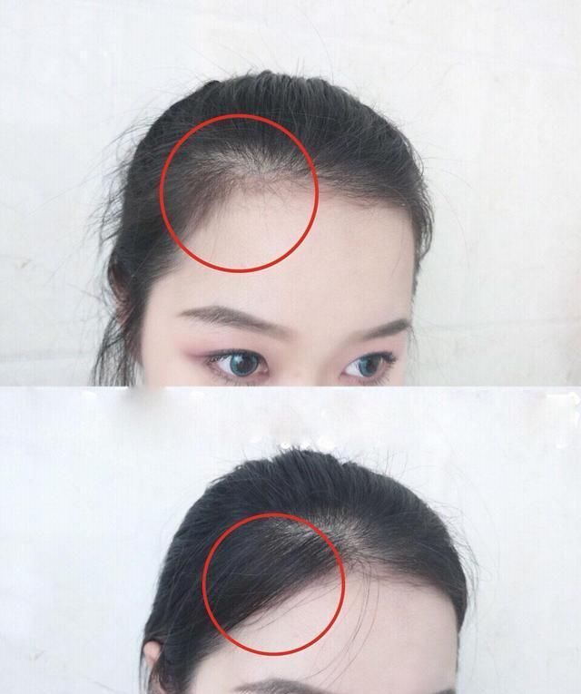  发际■发际线高该怎么办？教你剪遮住发髻线的刘海儿，一瞬间长相都变大了！