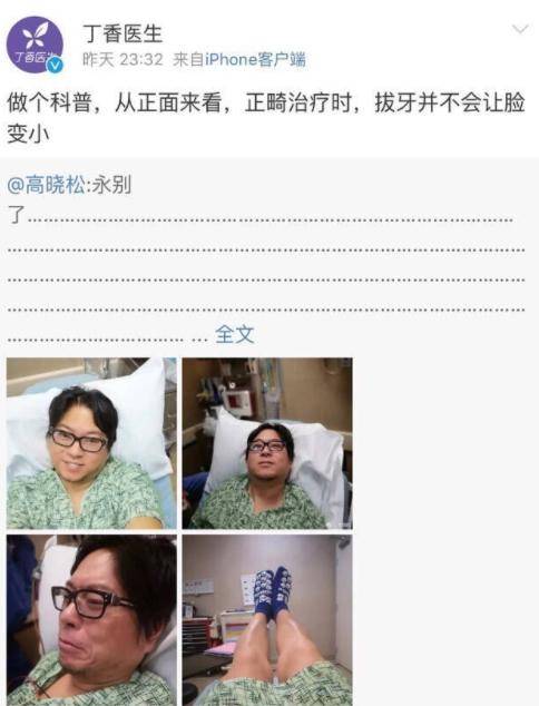 高晓松拔智齿被科普＂不会瘦脸＂ 丁香医生还曾多次怼薛之谦
