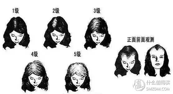 如何拯救油头星人、脱发怪人，这篇文章告诉你!!!