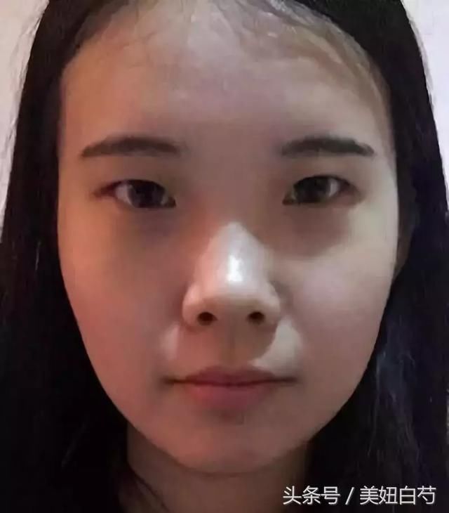 为什么她做了双眼皮却没有变美？
