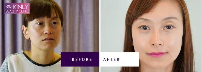 为何“老阿姨”萧亚轩总能交到小鲜肉男友?她的斩男秘籍到底有哪