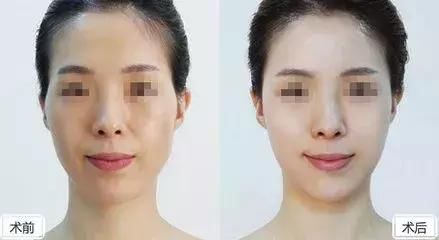 这是目前最流行的斩男脸TOP3，来看看自己属于哪种脸型