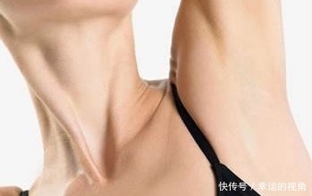  永久性@永久性腋下脱毛多少钱
