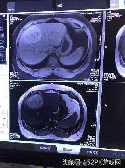 网曝PDD患病住院？女友已证实！嫖老师回应：看我神威无坚不摧