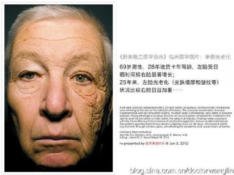  【脸上】为什么屁股比脸上的皮肤要好，不长斑，不起皱纹