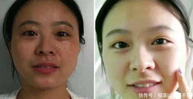 「见效快」牛奶加“它”敷脸,使用15天淡化色斑又美白,见效快还不花钱