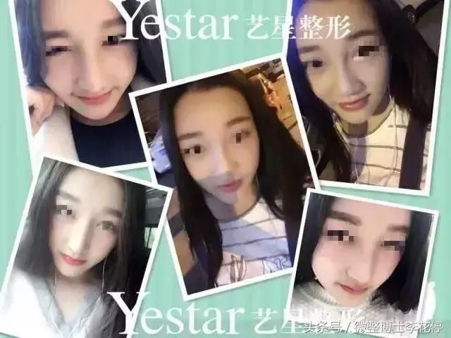 实锤：国民闺女，整容了？