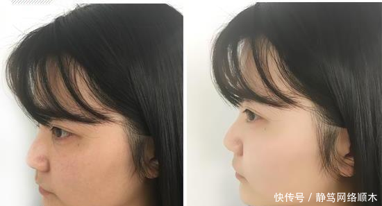  「适合」深扒一款有强大修复效果的面霜！适合各种问题肌