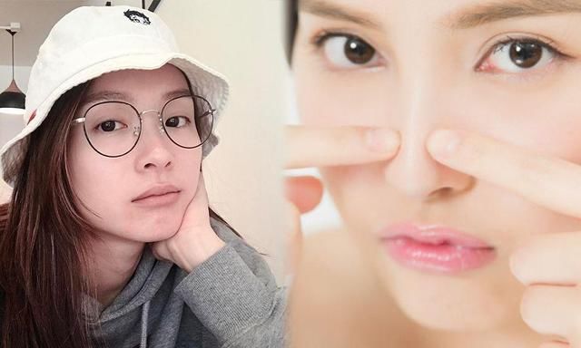 满脸都是白头粉刺!护肤7大步骤预防粉刺肌,打