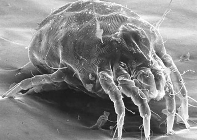 螨虫就是皮肤“祸星”，4异象出现，表示螨虫一步步霸占你的脸