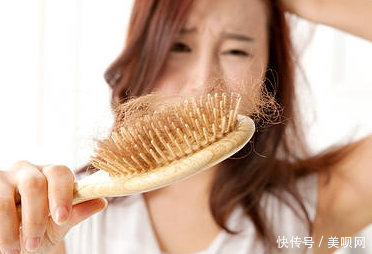 『发际』女生发际线越来越高怎么办?看这里,拒做“秃头”少女