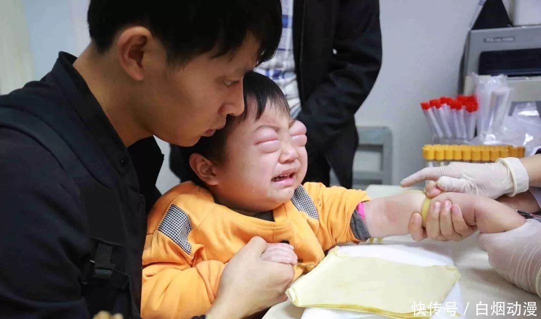 「发病」4岁男童患怪病病好时帅帅的,发病时肚大像怀孕双眼只剩一条线!