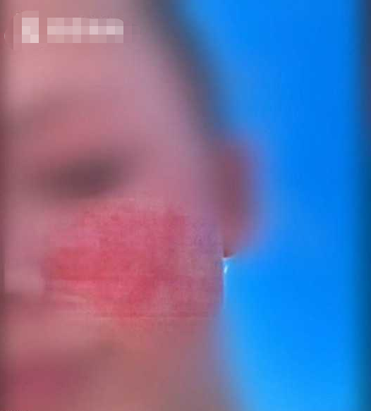 女儿鞋带没系好，发怒父亲狠狠咬她脸 出庭称“大脑冻住了”