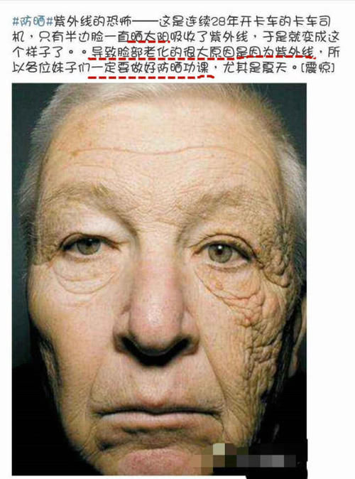  预防：脸上的斑点是如何形成的？看看这4种你有没有，最后一种可预防