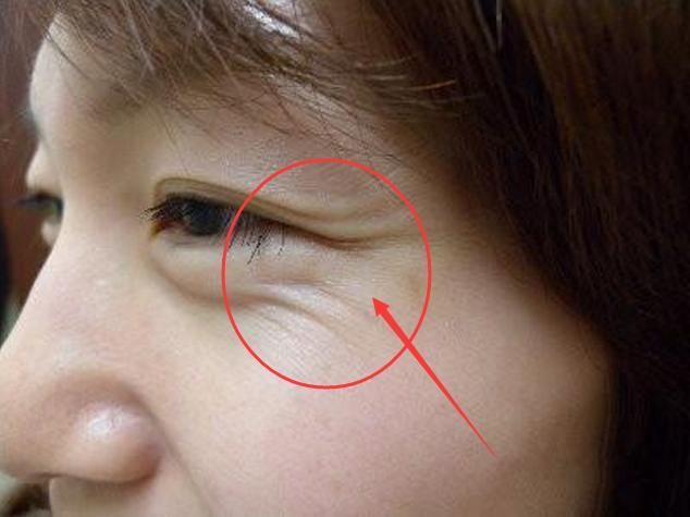 皮肤科主任:药店一白色乳液,每晚偷偷抹一抹,满满胶原蛋白