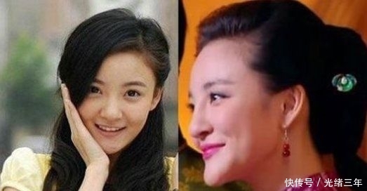 鼻子■鞠婧祎这是第几次do鼻子了？还没消肿就走红毯意外艳压全场！