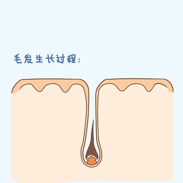 『黑色素』激光脱毛能永久脱毛吗?需要做几次?你想知道的都在这!