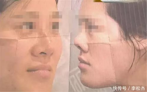 女子“改变外表”,不料变成了“猪鼻子”,网友:够我笑一年的了