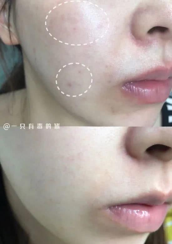  [科颜氏集焕]从几十试到上千块，终于找到有用的美白精华