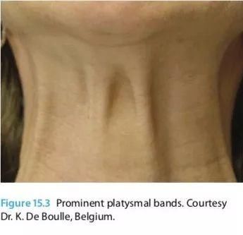 颈纹咋这么显老?别怪我没提醒，再晚就来不及了