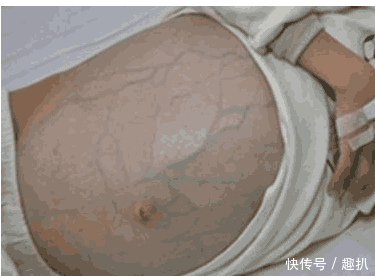 怀疑女儿早恋, 半年后女儿肚子疑似怀孕, 女儿离世, 母亲才知真相