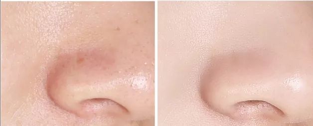 性价比逆天!大瓶好用的湿敷新宠，美白补水缩毛孔，0差评，上架就