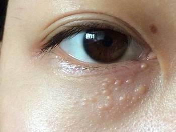 105岁姥姥说,药店放角落的药膏,早晚一抹,斑点、皱纹全消失