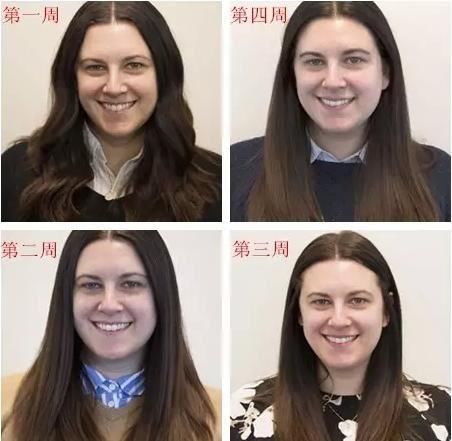 一个月不洗脸，会怎么样?看完惊呆了