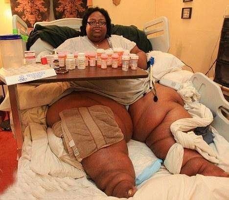 女子体重超重, 日常生活都在床上, 医生说再不减肥就会有生命危险