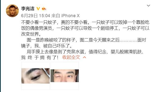 男星尴尬部位被蚊子咬后，导致整个剧组停工，网友：想上手摸一把