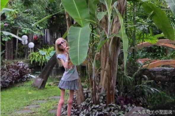 俄罗斯女子为减肥变成活骷髅，体重只剩42斤