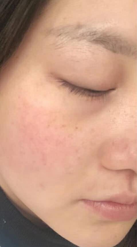 洗完脸后，牙膏这样用，脸蛋又水又嫩，超简单简单实用