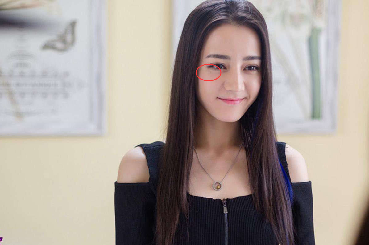 迪丽热巴的黑点,请大家不要选择视而不见