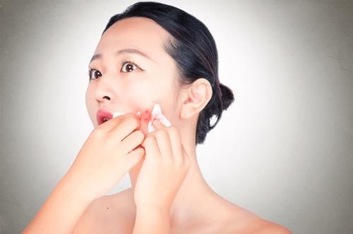  『脸上』脸上总是长脂肪粒怎么办？要不要挤掉？你做对了吗？看专家理解