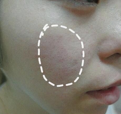 药店有俩种水，美白淡斑轻而易举，俩种原液配合使用效果更好哦!