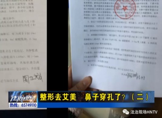  『院方提供』整形去艾美 鼻子穿孔了？