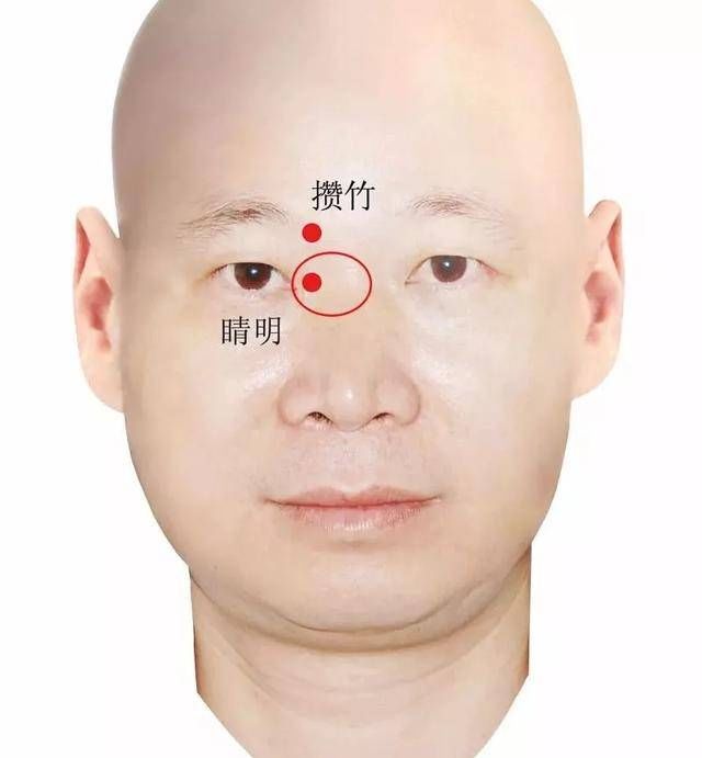  眼部：按摩这5个穴位帮你消除眼袋、黑眼圈，快学起来