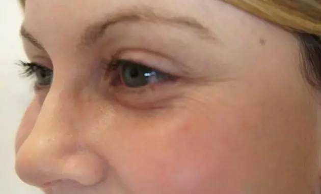 女人长斑显老又难看，教你个小秘方，快速淡斑!