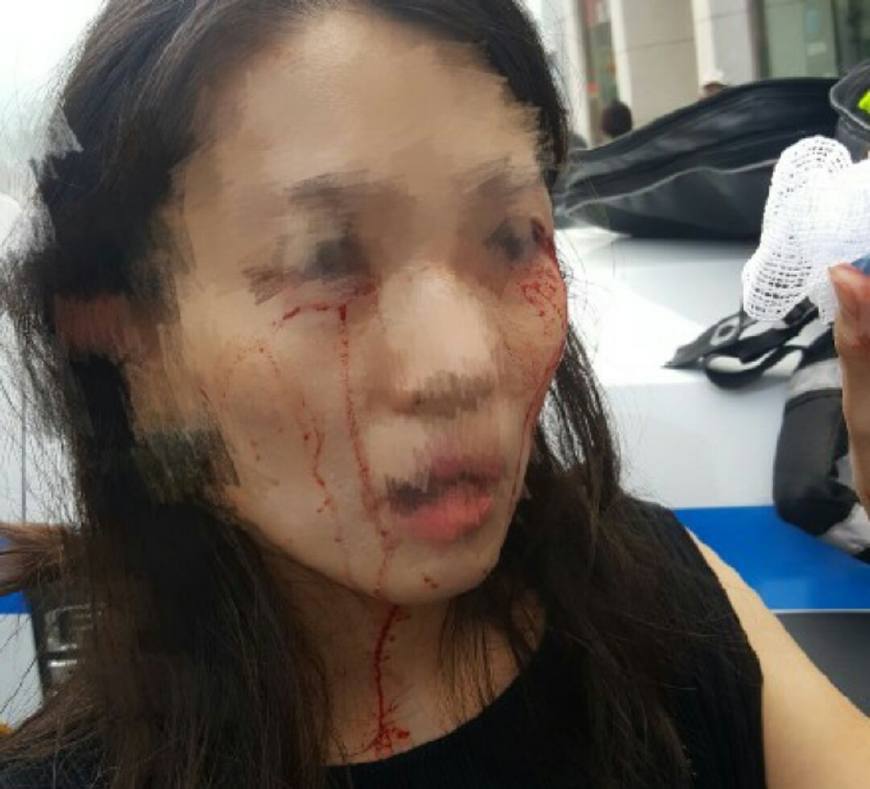 中国女生被黑人女子恶意殴打，警方竟直接不立案当场放走凶手