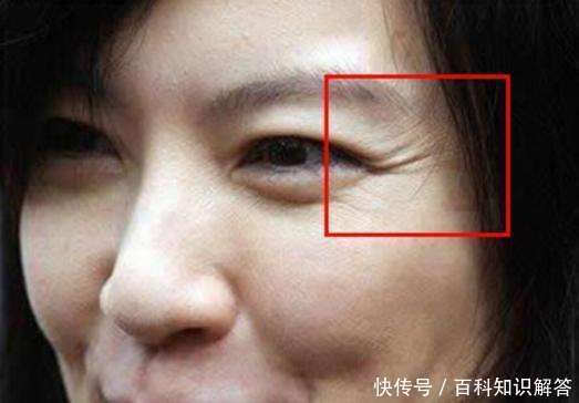 别傻傻敷面膜了！药店一几块钱便宜货抹脸上，几天淡化皱纹更紧致