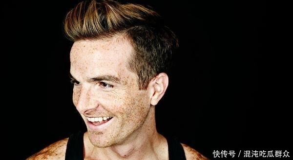 蔬菜和水果■男士脸上长斑怎么办?五个有效果的祛斑秘诀介绍