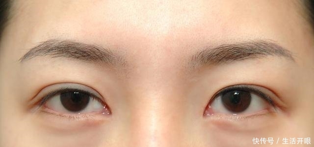  『眼霜』药店有二种“医用眼霜”，对付皱纹眼袋小菜一碟，遗憾是知道的人太少