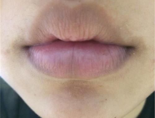  女性朋友|子宫“不好”的女性，一般会有“2黑2臭”的共性，但愿你一个不占